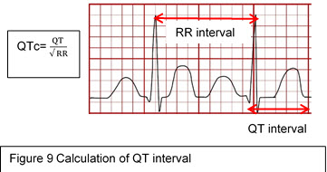 Calculation of QT interval